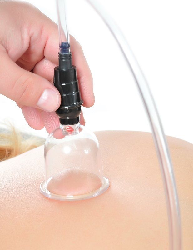 FETISH FANTASY SERIES - SET DI VENTOSE DA 6 PEZZI - FETISH FANTASY SERIES | Lingerie Harness Boutique